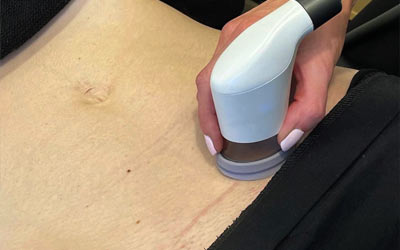 Scar Massage & LymphaTouch® in Tunbridge Wells: A gentle way to heal after surgery